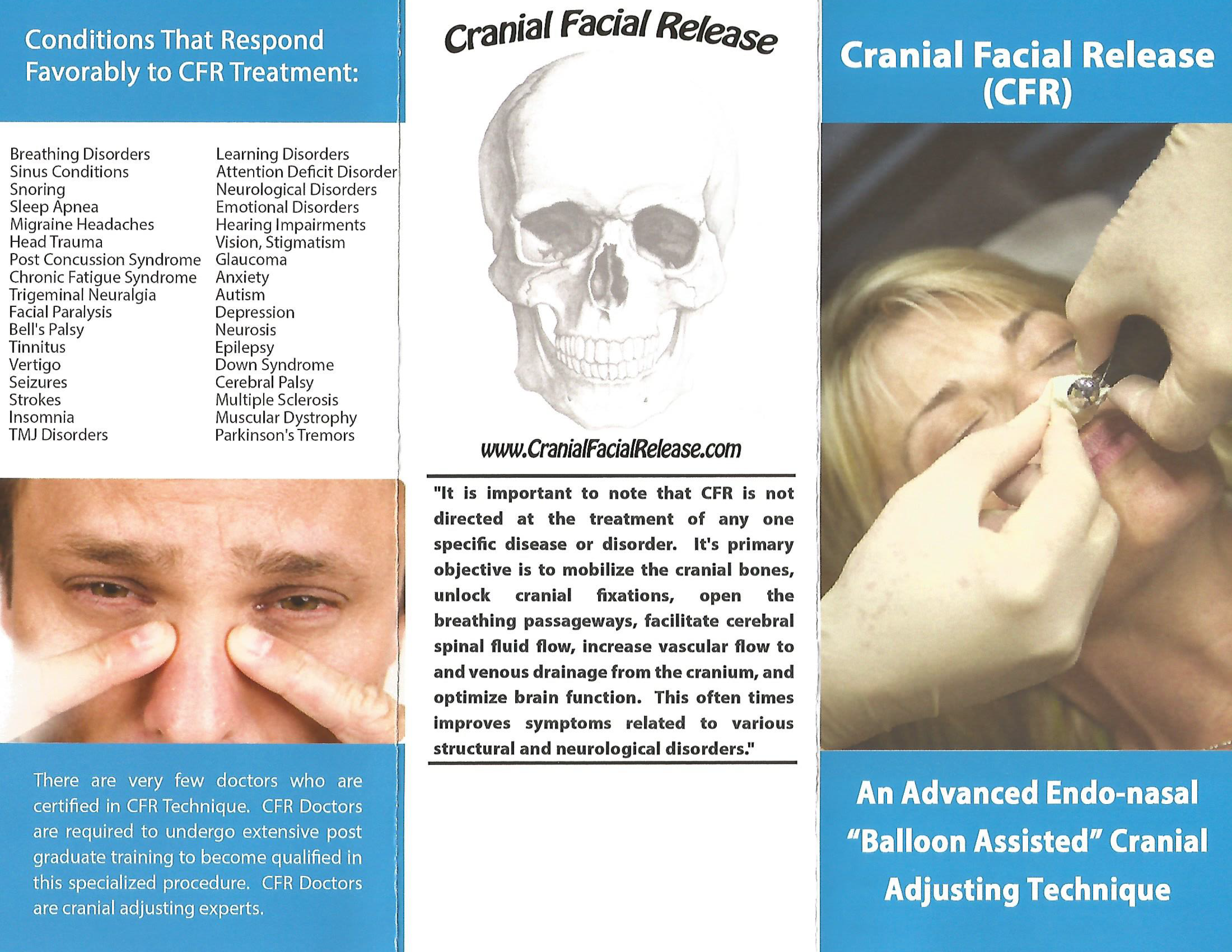 Lights O. reccomend Venous cranial facial syndrome