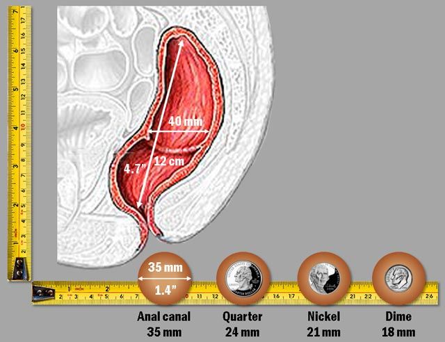 Difference between anal abcess and hemorroi