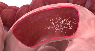 Inflamed burning anus after bowel movement