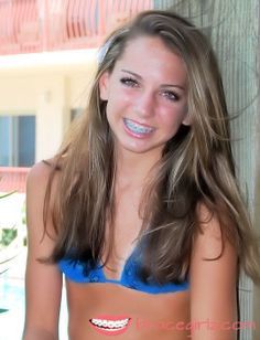 Braces teen girl fuck