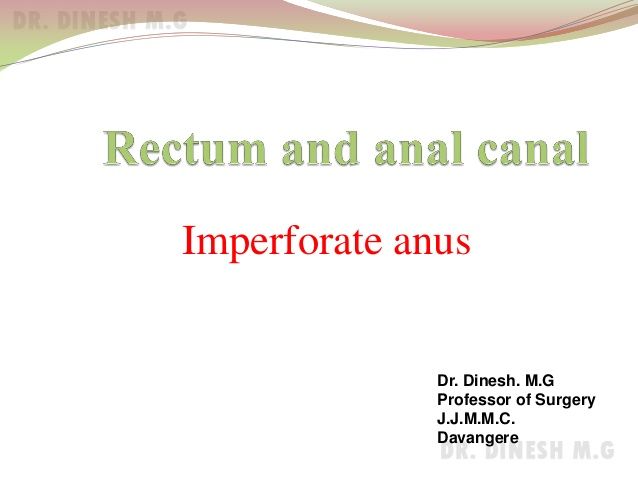 Ectopic anal canal